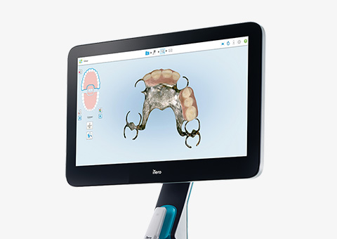 iTero Lumina Intraoralscanner für digitalen Zahnabdruck in Waldkraiburg