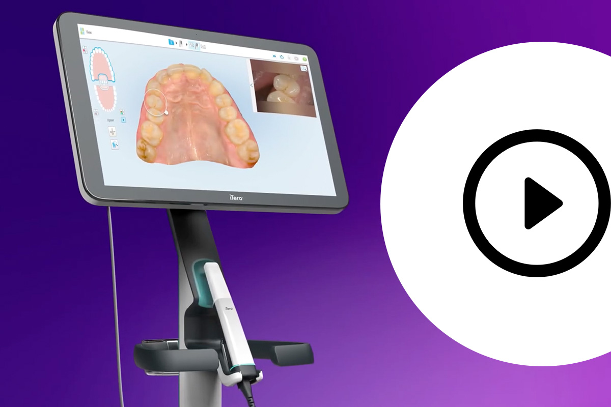 Vorschaubild zum iTero Lumina Scanner Video von Align Technology